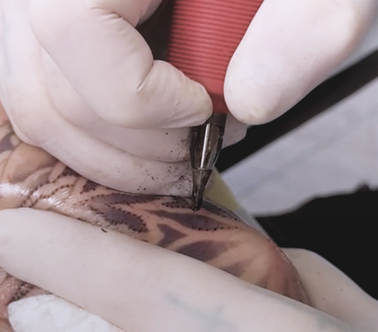 Safety of tattooing with STANDSTILL